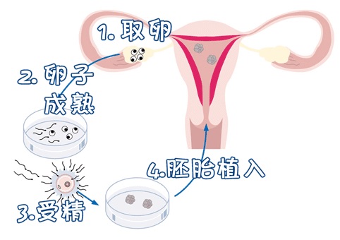 生殖妇科